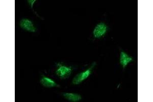 Image no. 5 for anti-Beclin 1, Autophagy Related (BECN1) antibody (ABIN1496869) (Beclin 1 Antikörper)
