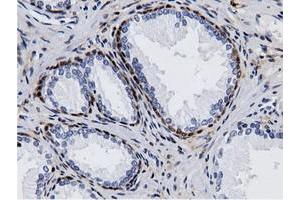 Immunohistochemical staining of paraffin-embedded Human liver tissue using anti-AK5 mouse monoclonal antibody. (Adenylate Kinase 5 Antikörper)