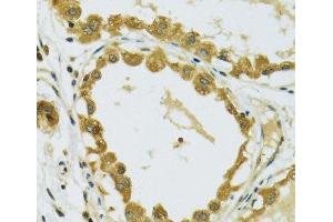 Immunohistochemistry of paraffin-embedded Human breast using RPS7 Polyclonal Antibody at dilution of 1:100 (40x lens). (RPS7 Antikörper)