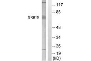 Western blot analysis of extracts from NIH-3T3 cells, treated with Insulin 0. (GRB10 Antikörper  (AA 33-82))