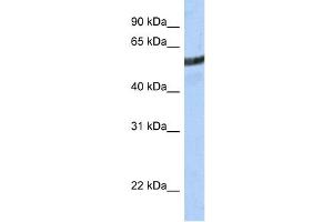 WB Suggested Anti-ME3 Antibody Titration:  0.