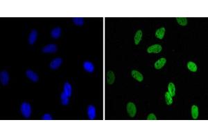 Immunofluorescence staining of HeLa cells using CBX1 monoclonal antibody, clone 5A3 (Green). (CBX1 Antikörper)