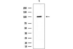 Western blot analysis of lysates from EC304 cells, using MCM2 Mouse Monoclonal Antibody at 1/1000 dilution.