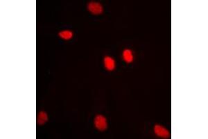 Immunofluorescent analysis of ADAR2 staining in MCF7 cells. (RED1 Antikörper  (Center))