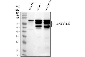 Western blot analysis of Synapsin II using anti-Synapsin II antibody (ABIN4886735). (SYN2 Antikörper  (AA 497-582))