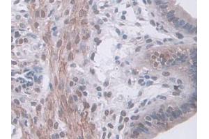 IHC-P analysis of Mouse Uterus Tissue, with DAB staining. (HSF4 Antikörper  (AA 159-411))