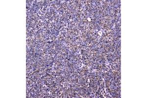 IHC analysis of cortactin using anti-cortactin antibody (ABIN6719306).