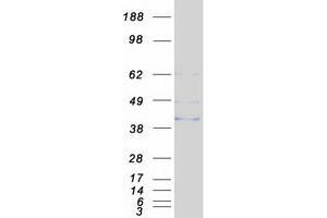 Validation with Western Blot (ANTXR1 Protein (Transcript Variant 3) (Myc-DYKDDDDK Tag))