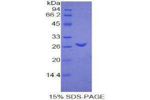 SDS-PAGE analysis of Rat TMEM173 Protein. (STING/TMEM173 Protein)