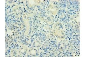 Immunohistochemistry of paraffin-embedded human pancreatic tissue using ABIN7155743 at dilution of 1:100 (HOXB5 Antikörper  (AA 1-170))