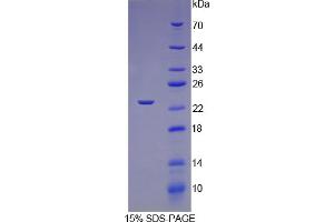 SDS-PAGE analysis of Rat TNNI1 Protein.