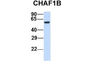 Host:  Rabbit  Target Name:  CHAF1B  Sample Type:  Human Adult Placenta  Antibody Dilution:  1. (CHAF1B Antikörper  (N-Term))