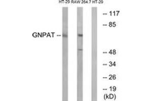 Western blot analysis of extracts from HT-29/RAW264. (GNPAT Antikörper  (AA 231-280))