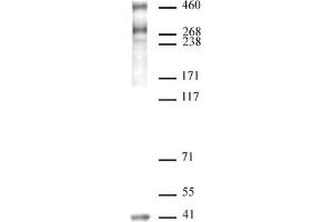 SMRT / NCoR2 antibody (pAb) tested by Western blot. (NCOR2 Antikörper  (N-Term))