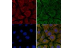 ABIN6257444 and ABIN6275462 staining Hela cells by IF/ICC. (RAB26 Antikörper  (C-Term))