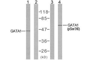Western blot analysis of extract from COS7 cells untreated or treated with EPO using GATA1 (Ab-310) antibody (E021042, Line 1 and 2) and GATA1 (phospho-Ser310) antibody (E011042, Line 3 and 4). (GATA1 Antikörper  (pSer310))