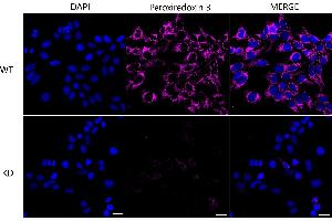 Immunocytochemical staining of Hela cells using Peroxiredoxin 3 antibody (ABIN7799778), 1:1,000), Top panel: wild-type (WT), Bottom panal: Peroxiredoxin 3 shRNA knockdown (KD). (Rekombinanter Peroxiredoxin 3 Antikörper)