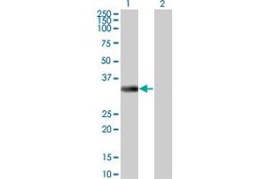 Western Blot analysis of ITPK1 expression in transfected 293T cell line by ITPK1 monoclonal antibody (M01), clone 2C8. (ITPK1 Antikörper  (AA 1-314))