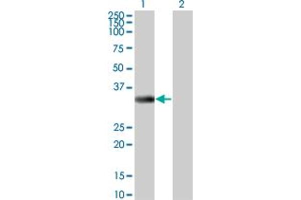 ITPK1 抗体  (AA 1-314)