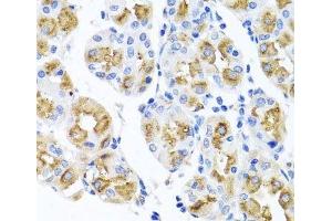 Immunohistochemistry of paraffin-embedded Human stomach using FECH Polyclonal Antibody at dilution of 1:100 (40x lens). (FECH Antikörper)