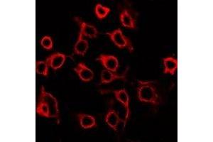 Immunofluorescent analysis of EP2 staining in HuvEc cells. (PTGER2 Antikörper  (C-Term))