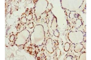 Immunohistochemistry of paraffin-embedded human thyroid tissue using ABIN7163952 at dilution of 1:100 (KCNA3 Antikörper  (AA 486-575))
