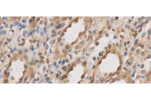 Immunohistochemistry of paraffin-embedded Rat kidney using IL10RB Polyclonal Antibody at dilution of 1:50 (IL10RB Antikörper)