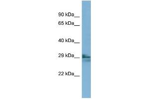 WB Suggested Anti-LIM2 Antibody Titration:  0. (LIM2 Antikörper  (N-Term))