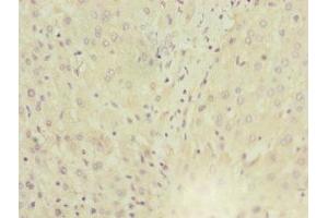 Immunohistochemistry of paraffin-embedded human liver tissue using ABIN7143763 at dilution of 1:100 (MGAT1 Antikörper  (AA 156-445))