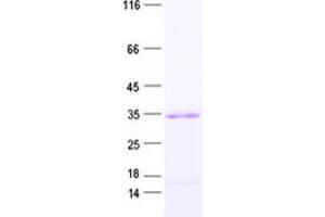 Validation with Western Blot (STPG1 Protein (His tag))