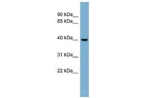 VPS37C antibody used at 1 ug/ml to detect target protein.
