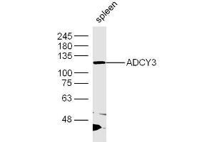 Mouse spleen lysates probed with ADCY3 Polyclonal Antibody, Unconjugated  at 1:300 dilution and 4˚C overnight incubation. (ADCY3 Antikörper  (AA 651-750))