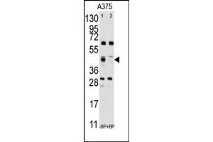 Image no. 1 for anti-Farnesyl-Diphosphate Farnesyltransferase 1 (FDFT1) (Middle Region) antibody (ABIN357712) (FDFT1 Antikörper  (Middle Region))