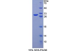 Image no. 1 for POU Class 5 Homeobox 1 (POU5F1) (AA 129-352) protein (His tag) (ABIN4988420)