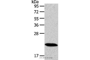 Western blot analysis of Mouse heart tissue, using RAB18 Polyclonal Antibody at dilution of 1:400 (RAB18 Antikörper)