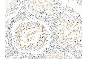ABIN7093129 and ABIN7098933 at 1/100 staining Rat testis tissue by IHC-P. (BAGE2 Antikörper  (Internal Region))