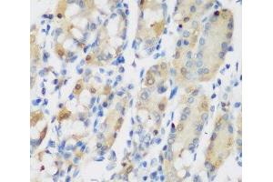 Immunohistochemistry of paraffin-embedded Human stomach using RRM1 Polyclonal Antibody at dilution of 1:200 (40x lens). (RRM1 Antikörper)