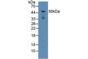 Figure. (LAMP2 Antikörper  (AA 295-410))