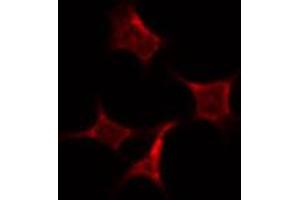 ABIN6274040 staining HepG2 by IF/ICC. (PRC1 Antikörper  (Internal Region))