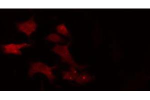 ABIN6274842 staining 293 cells by IF/ICC. (APPBP2 Antikörper  (Internal Region))