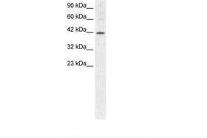 Image no. 1 for anti-Mesoderm Induction Early Response 1 (MIER1) (AA 250-293) antibody (ABIN202515) (MIER1 Antikörper  (AA 250-293))