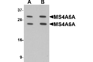 Western blot analysis of MS4A6A in 293 cell lysate with MS4A6A antibody at (A) 1 and (B) 2 µg/mL. (MS4A6A Antikörper  (N-Term))