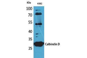 Western Blotting (WB) image for anti-Calbindin (CALB1) (C-Term) antibody (ABIN3178240) (CALB1 Antikörper  (C-Term))