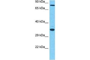 Host:  Rabbit  Target Name:  MGAT5  Sample Type:  OVCAR-3 Whole Cell lysates  Antibody Dilution:  1.