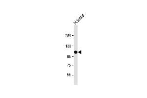 Anti-SLC14A2 Antibody (N-Term) at 1:500 dilution + Human testis lysate Lysates/proteins at 20 μg per lane. (Solute Carrier Family 14 (Urea Transporter, Kidney) Member 2 (SLC14A2) (AA 42-76) Antikörper)
