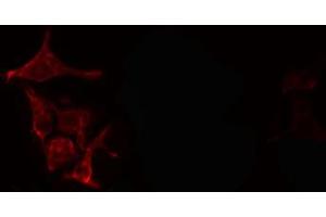 ABIN6266621 staining NIH-3T3 cells by IF/ICC. (PDGFB Antikörper  (N-Term))
