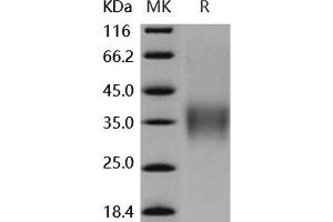 Western Blotting (WB) image for Low Affinity Immunoglobulin gamma Fc Region Receptor IV (FCGR4) (Active) protein (His tag,AVI tag) (ABIN7196849)