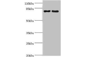 Western blot All lanes: MTRR antibody at 2 μg/mL Lane 1: PC-3 whole cell lysate Lane 2: HepG2 whole cell lysate Secondary Goat polyclonal to rabbit IgG at 1/10000 dilution Predicted band size: 81, 78, 7 kDa Observed band size: 81 kDa (MTRR Antikörper  (AA 1-725))