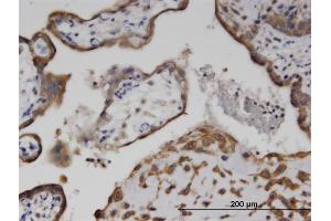 Immunoperoxidase of monoclonal antibody to C6orf199 on formalin-fixed paraffin-embedded human placenta. (AKD1 Antikörper  (AA 321-421))