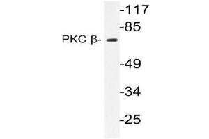 Western blot (WB) analysis of PKC beta antibody in extracts from HeLa cells (PKC beta Antikörper)